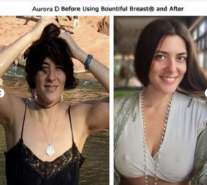 Bountiful Breast Cream Aurora